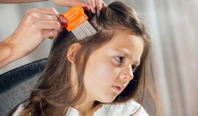 đầu c&oacute; chấy